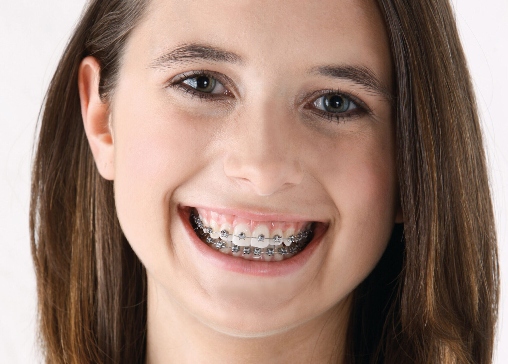 Orthodontic wire