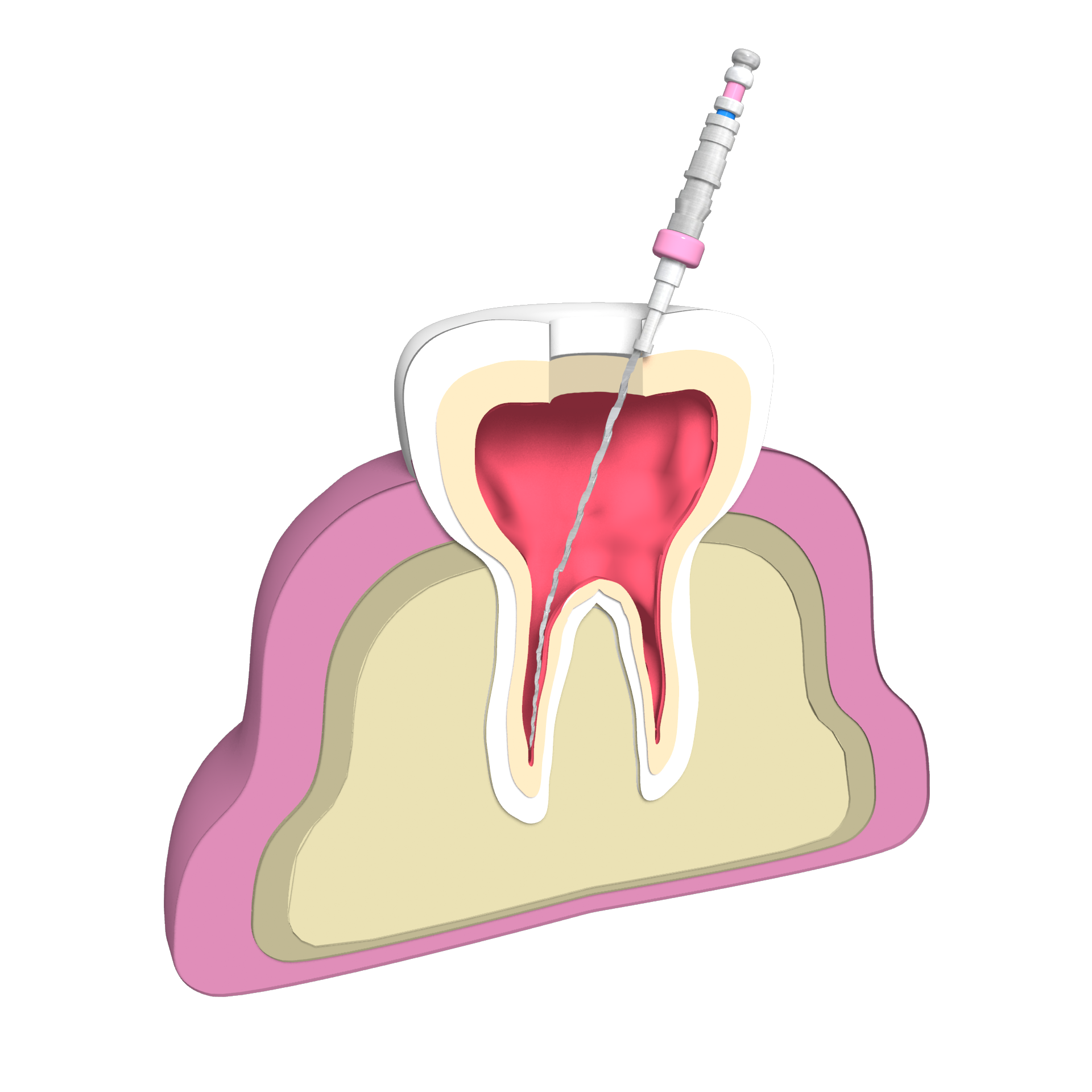 歯列矯正・歯科